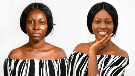 Excès de sébum : mauvais pour une peau noire